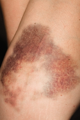 4 ever. Eine Fotoarbeit von Phillip Zwanzig. Ausstellung 2016 im Raum Vollreinigung in Berlin, Kreuzberg. 